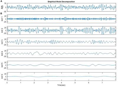 Non-linear Entropy Analysis in EEG to Predict Treatment Response to Repetitive Transcranial Magnetic Stimulation in Depression